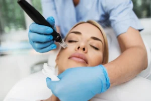 Vivace Microneedling: Types, Benefits, and How It Enhances Your Skin - Ciao Bella Salon and Spa, Islamorada