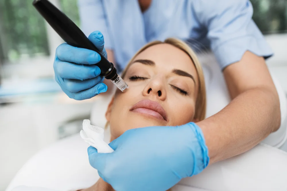 Vivace Microneedling: Types, Benefits, and How It Enhances Your Skin - Ciao Bella Salon and Spa, Islamorada