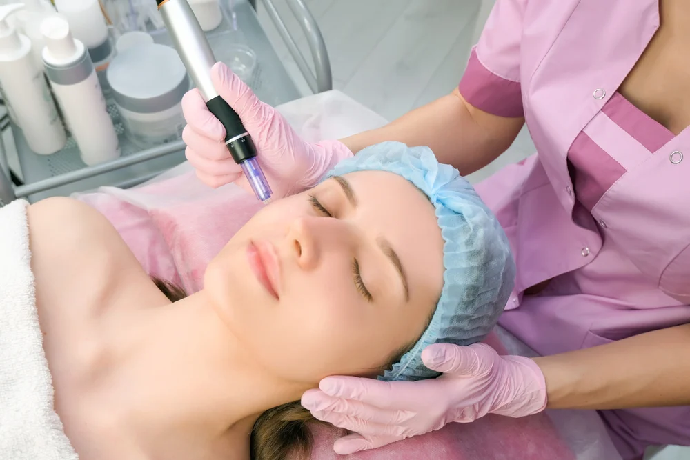 Vivace Microneedling: Types, Benefits, and How It Enhances Your Skin 2 Vivace Microneeling 02