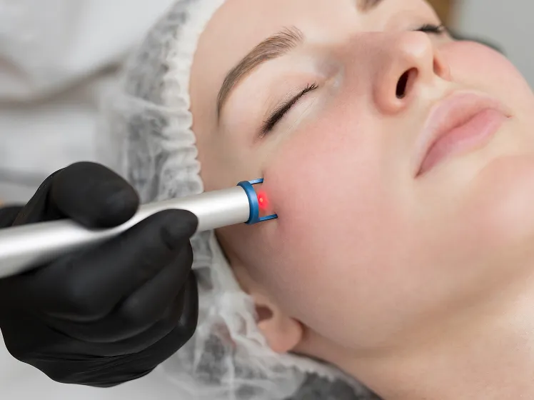Ultra MD Laser Resurfacing​