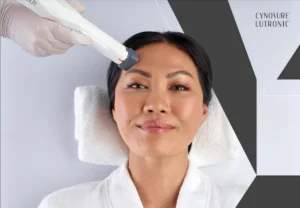 Is XERF Right for You? Key Signs You Could Benefit From RF Skin Tightening