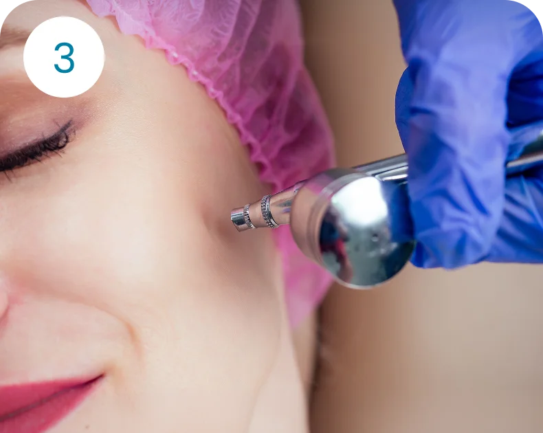 High-Pressure Oxygen Spray at Ciao Bella Med Spa