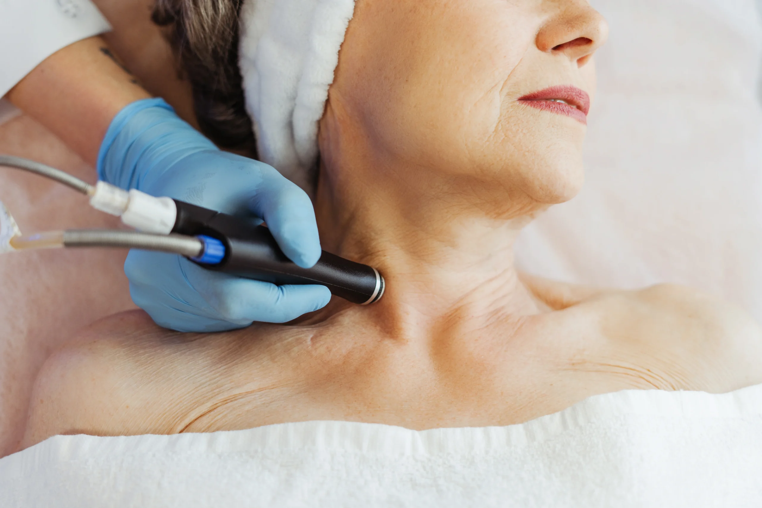 mature woman receiving neck skin treatment - What Is the Difference Between XERF and Traditional Radiofrequency Treatments?