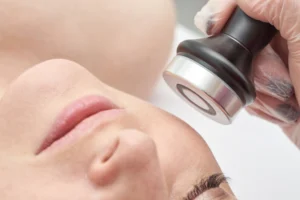 woman receiving facial lskin treatment in clinic - What Are the Real Benefits of XERF Structural Skin Tightening for Non-Surgical Rejuvenation