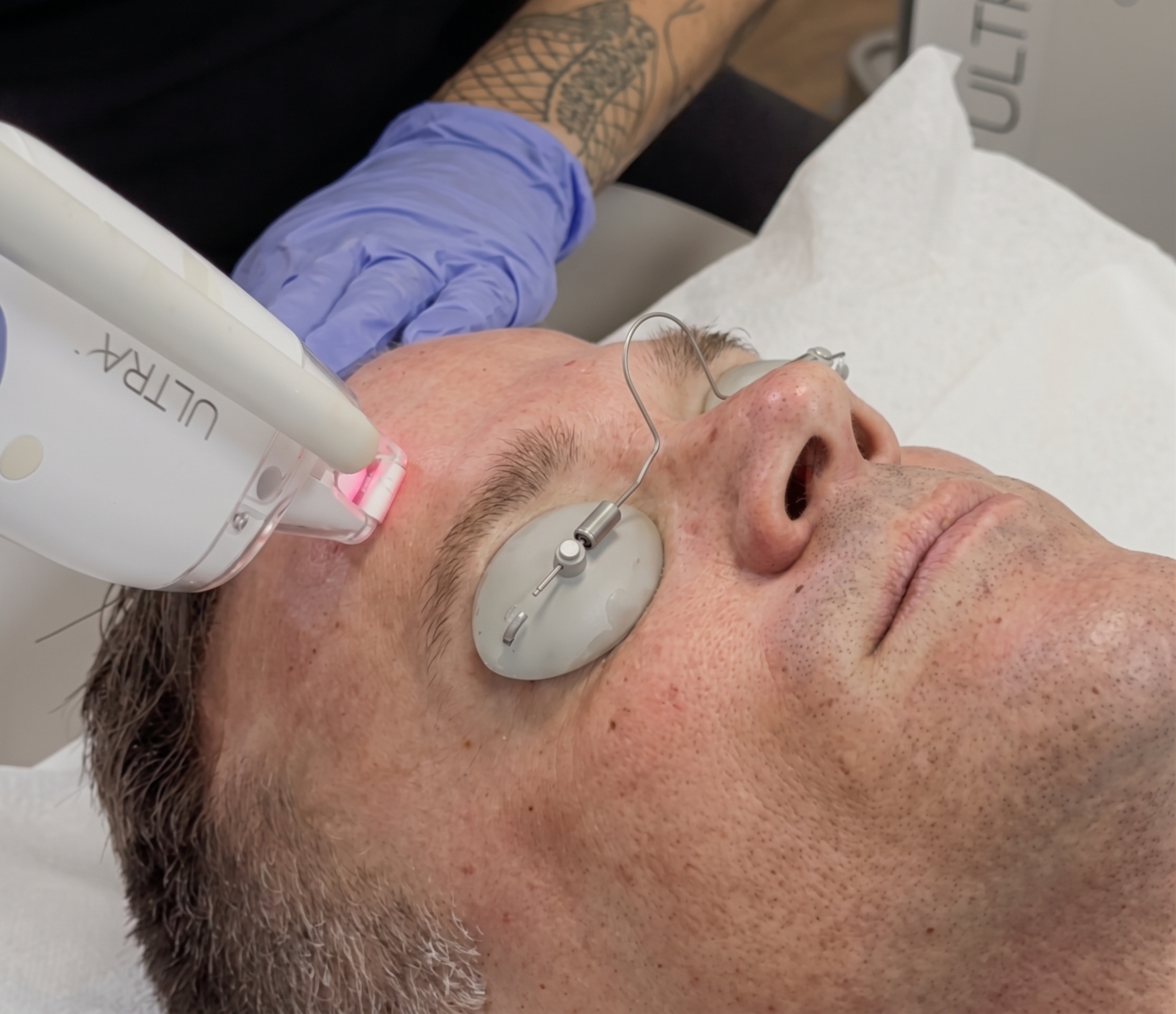man receiving LaseMD ULTRA